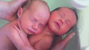 Rüyada Hastanede ikiz Çocuğu Olduğunu Görmek